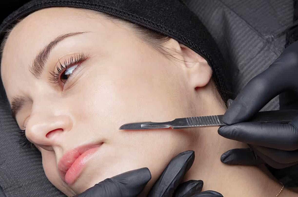 11 Reasons Dermaplaning Will Immediately Improve Your Skin