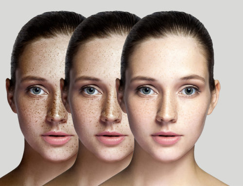 Lumecca – Superior Skincare with Amazing Results