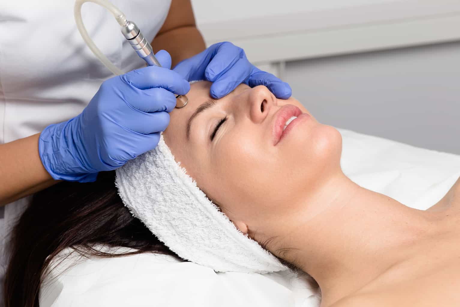 Microneedling
