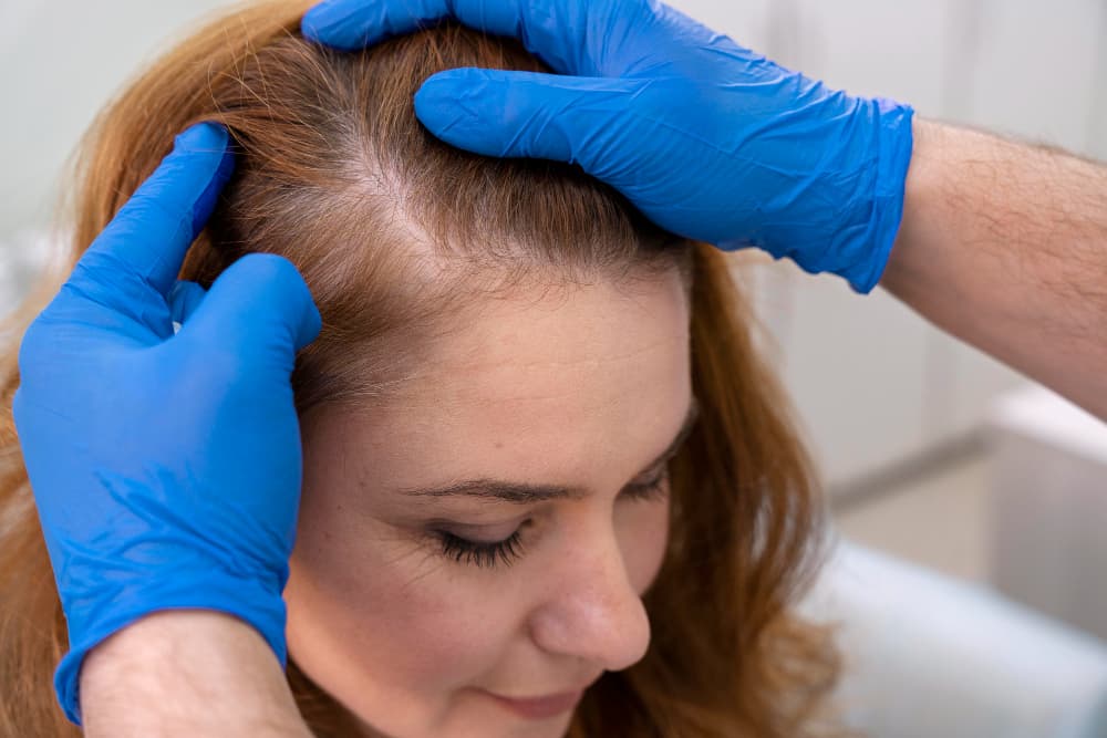 PRP Hair Restoration