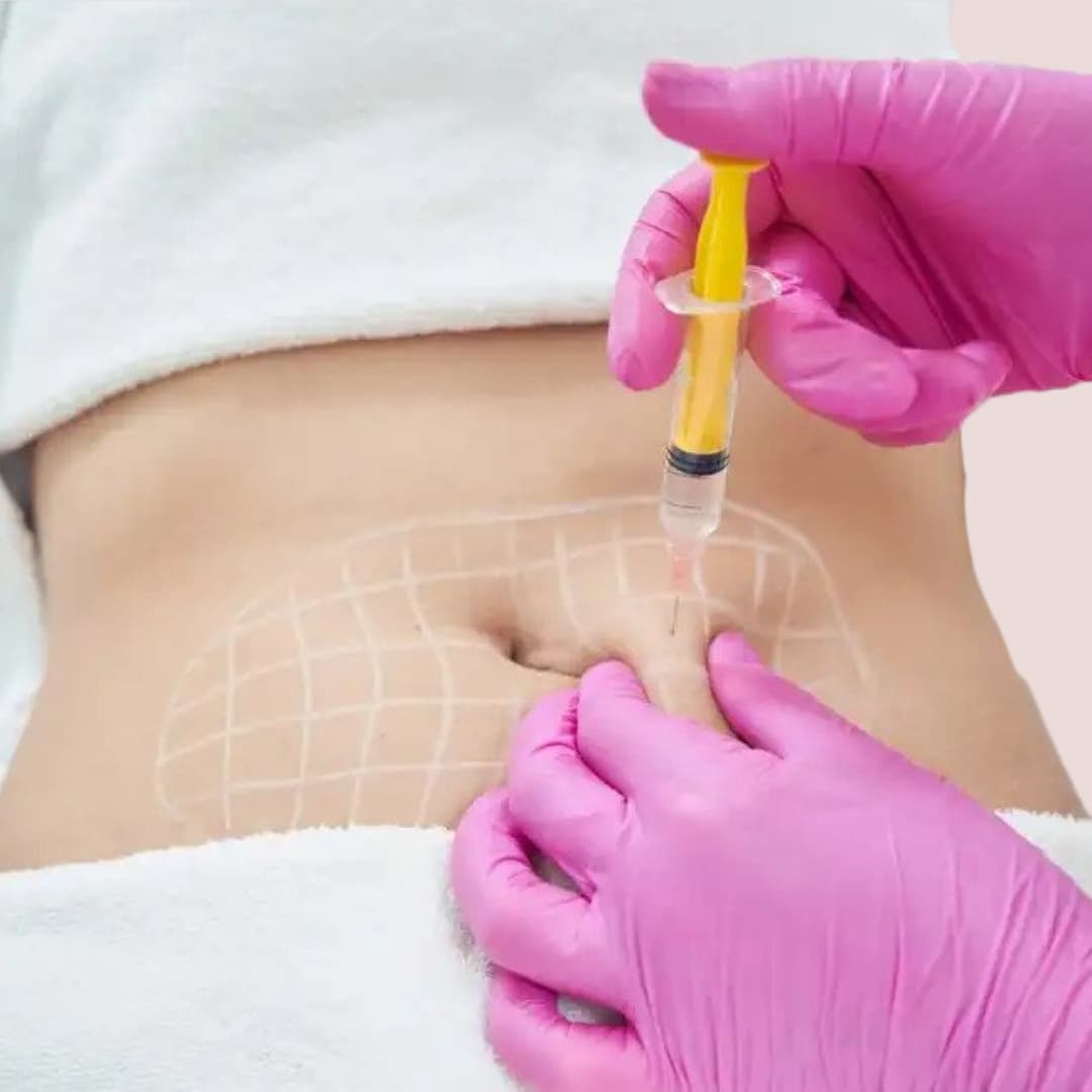 Kybella and LipoDissolve.